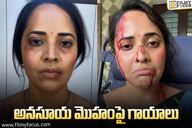 Anasuya: హాట్ టాపిక్ అయిన అనసూయ లేటెస్ట్ ఫోటోలు.. టెన్షన్ లో అభిమానులు.!