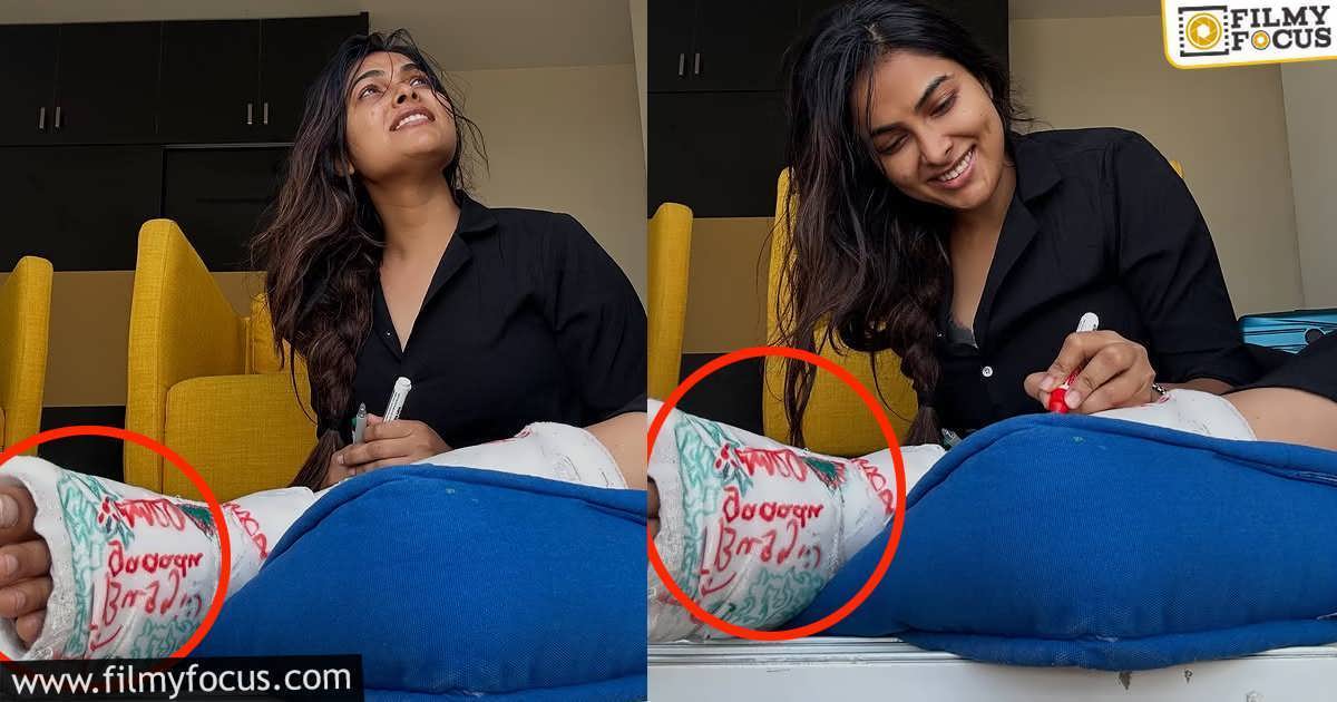 Actress Divi Vadthya Leg Injury Latest Post Goes Viral (1)