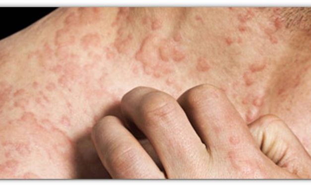 सिर्फ 1 घंटे में पुराने और जिद्दी खुजली, दाद खरजवा से छुटकारा पाने के लिए अपनाए बेहतरीन देसी इलाज, दोबारा नहीं होगी यह समस्या