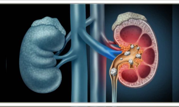क्या आप भी पथरी की समस्या से जूझ रहे हैं? तो अपनाएं यह घरेलू उपाय, चुटकी में गायब हो 15 mm तक की पथरी, जानिए यह बहुत उपयोगी है