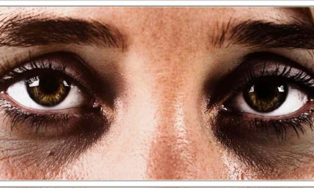 यदि आपकी आंखों के पास काला घेरा(डार्क सर्कल) है, तो अपनाई यह उपाय, जल्द ही ठीक हो जाएगा