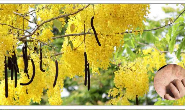 मिनटों में खुजली से निजात दिलाएगा अमलतास और इसका फल, जानिए इसके अन्य फायदे भी।