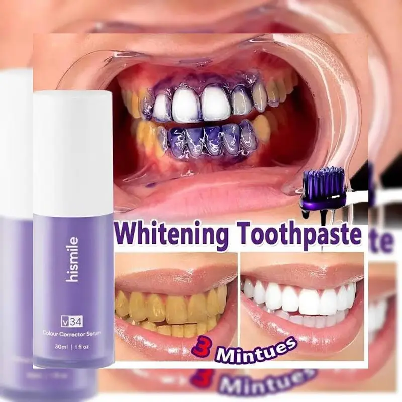 Teeth whitening pen(For brightening your smile)