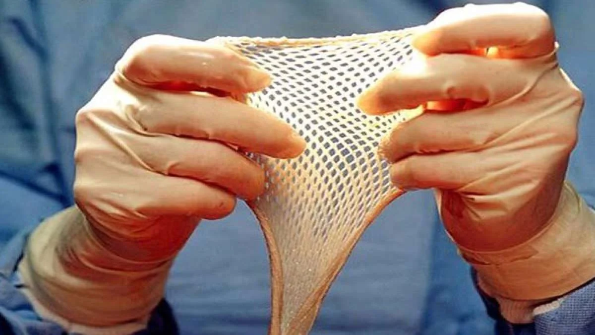 kerala skin bank news