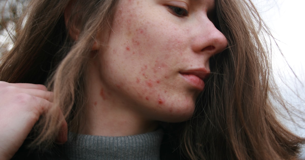 a woman with a substance on her face